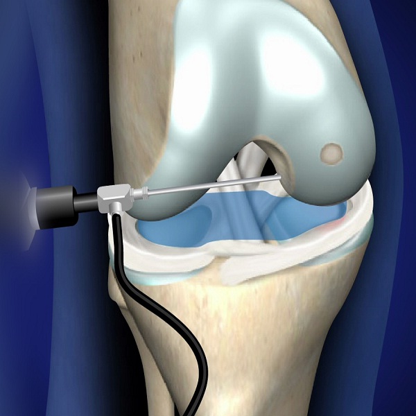 Contact Dr. Dhruv Patel for Arthroscopy Surgery Specialist in Navi Mumbai, Vashi & Belapur